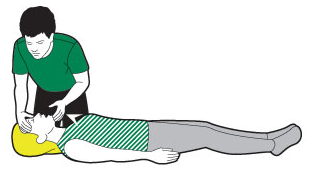 Open the airway adult